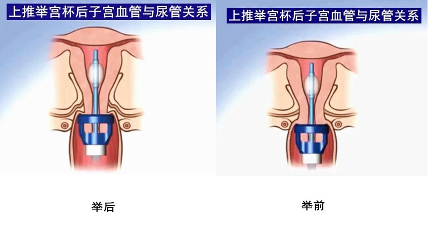举宫.jpg